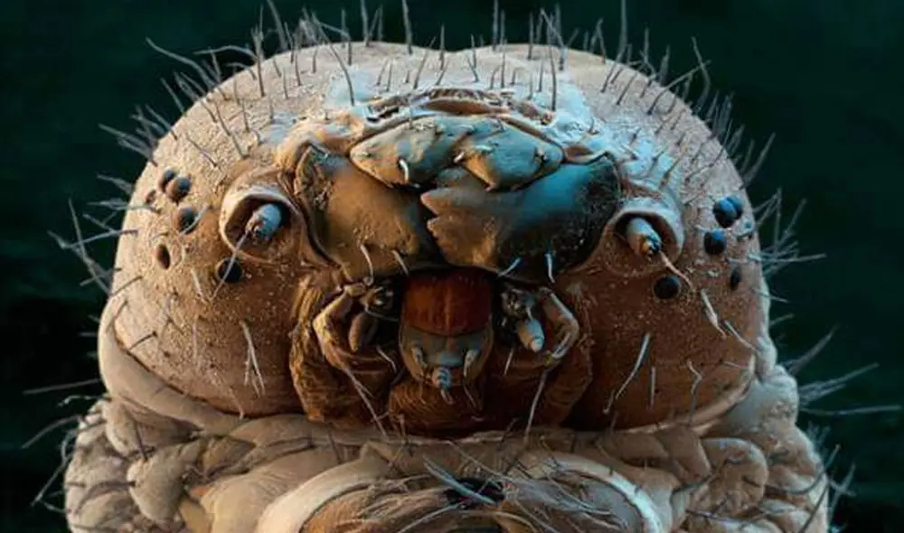 Demodex folliculorum captado bajo microscopio electrónico. Foto: @theRCVS / Twitter Demodex folliculorum captado bajo microscopio electrónico. Foto: @theRCVS / Twitter