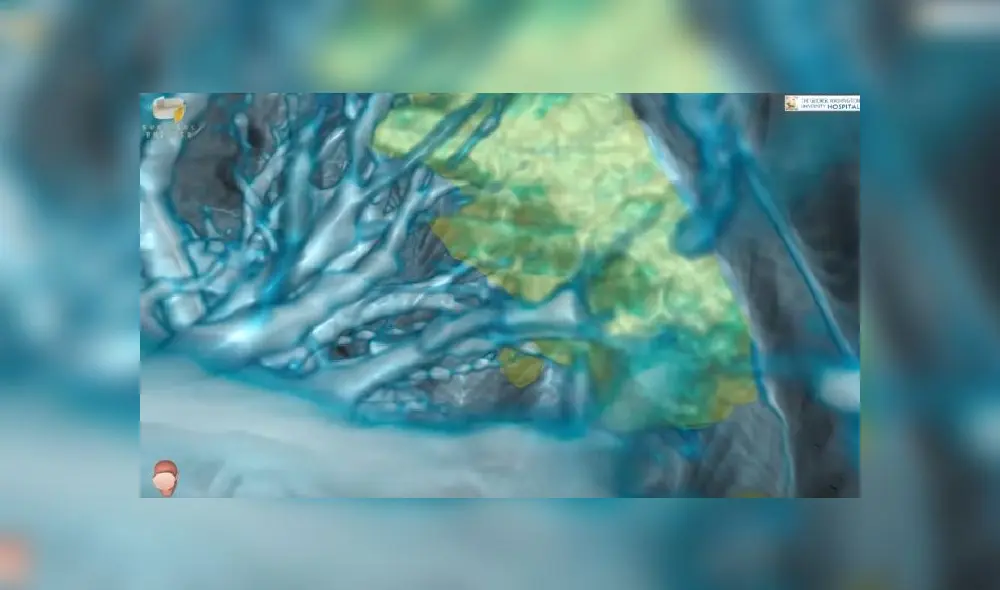 Coronavirus y pulmones Coronavirus y pulmones