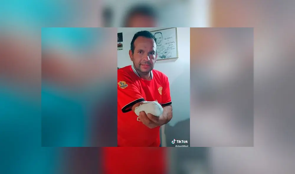 Desliza las imágenes para ver la increíble prótesis casera que construyó este hombre para su brazo amputado. Foto: dani98gil/TikTok