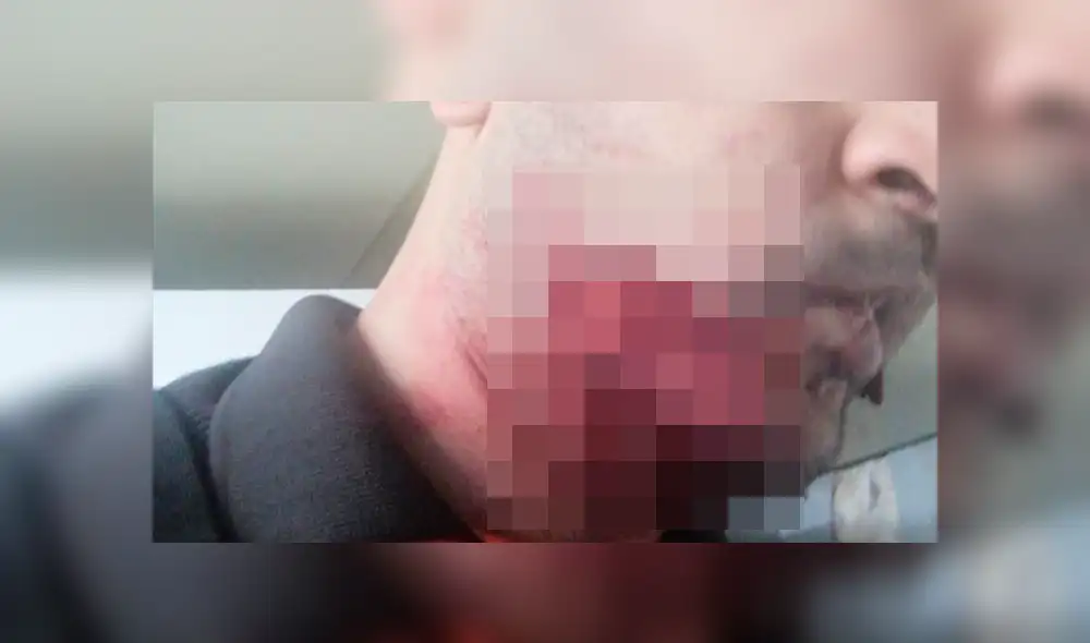 Atacan a mordiscos a vigilante de seguridad del metro [FOTOS] 