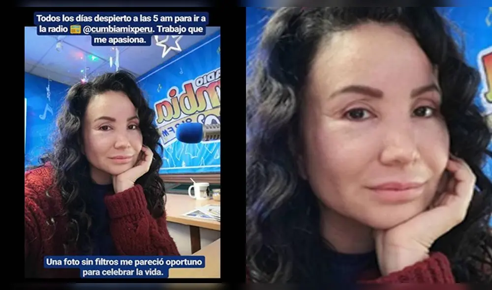 Janet Barboza muestra su belleza natural para demostrar que no usa botox