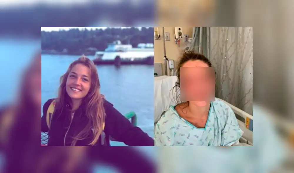 Ciudadana española que reside en Estados Unidos pide donación tras quemarse la cara y ojos con soda caústica. Foto: La Vanguardia