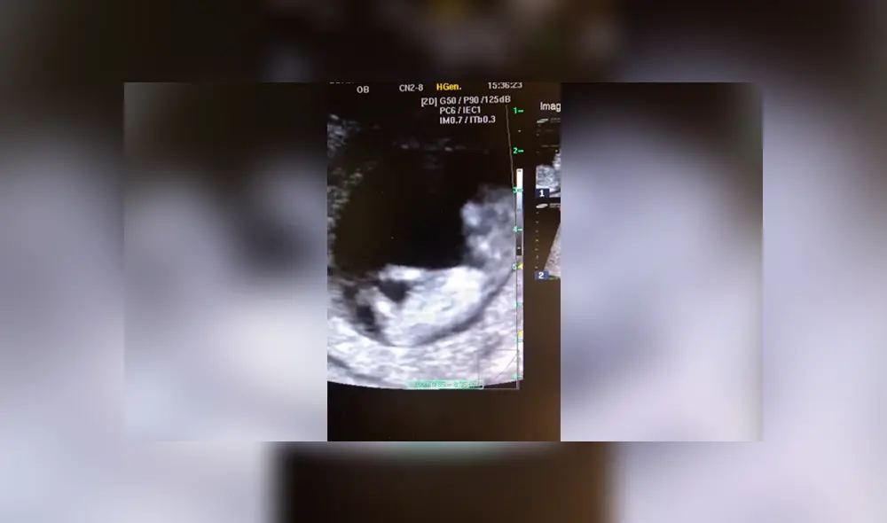 Facebook viral: bebé de 12 semanas juega a la ‘resbaladilla’ en el vientre de su madre y todo queda registrado Facebook viral: bebé de 12 semanas juega a la ‘resbaladilla’ en el vientre de su madre y todo queda registrado