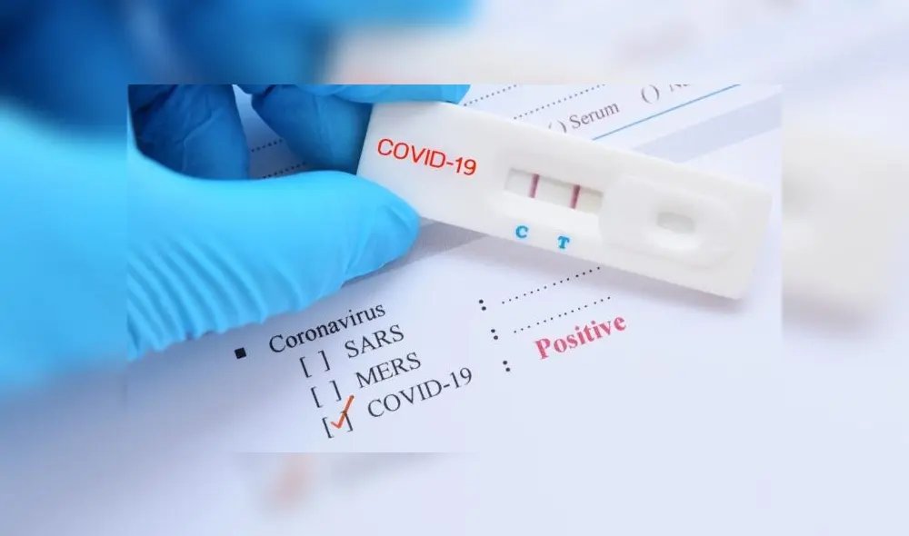 Pruebas COVID-19