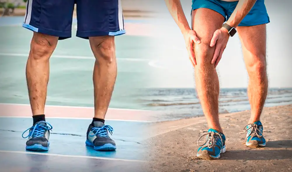 Se considera normal que en niños hasta los 3 años se tenga la característica de las piernas arqueadas. Foto: composición de Gerson Cardoso/La República/Freepik Se considera normal que en niños hasta los 3 años se tenga la característica de las piernas arqueadas. Foto: composición de Gerson Cardoso/La República/Freepik