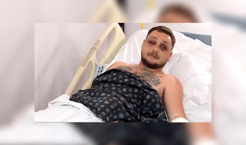 Queda con el rostro desfigurado tras defender a mujer maltratada por su pareja [VIDEO]