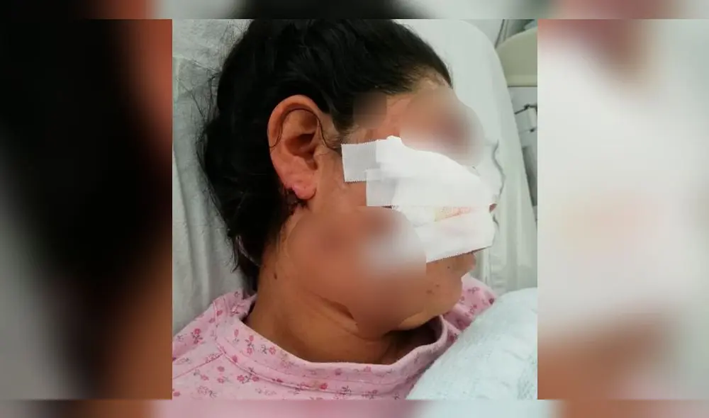 Piden ayuda para tía de niña asesinada en Apurímac que resultó herida durante protesta [VIDEO]