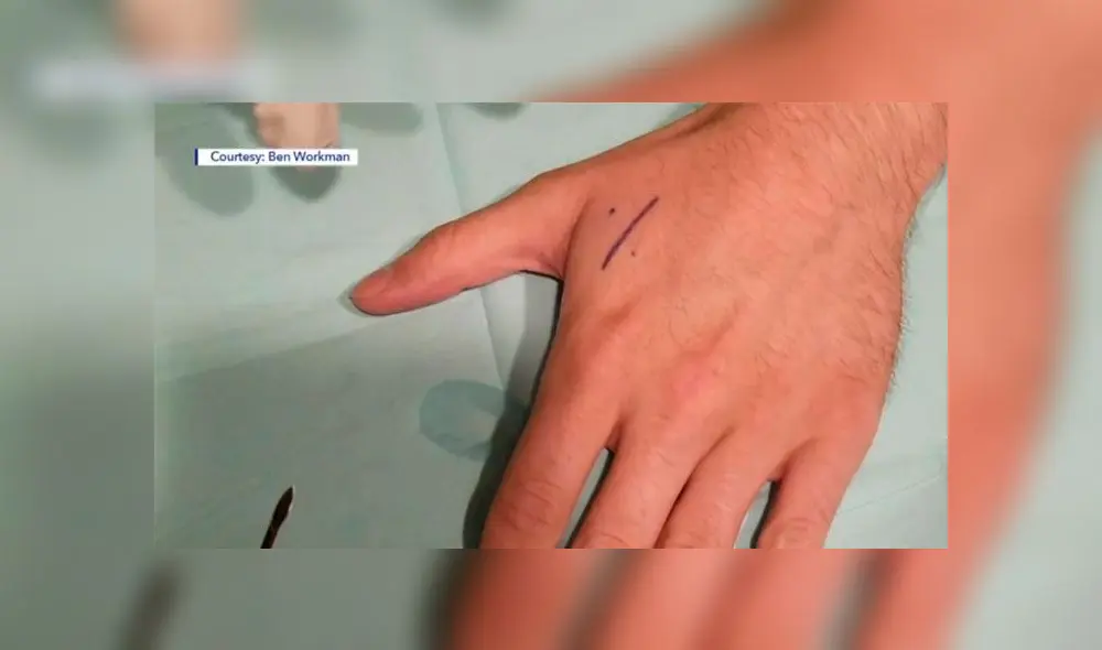 Ben Workman se inyectó unos chips para poder abrir el automovil de Tesla y manejar otras herramientas. Foto: Ben Workman Ben Workman se inyectó unos chips para poder abrir el automovil de Tesla y manejar otras herramientas. Foto: Ben Workman