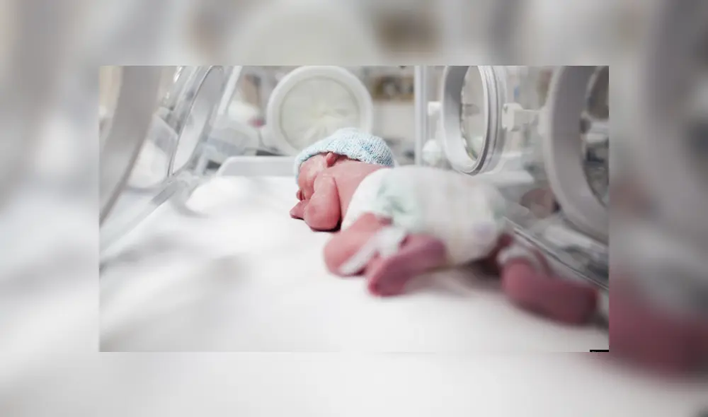 La ictiosis Arlequín, una enfermedad que le tocó vivir a una joven familia en Perú, tras el nacimiento de su hijo.