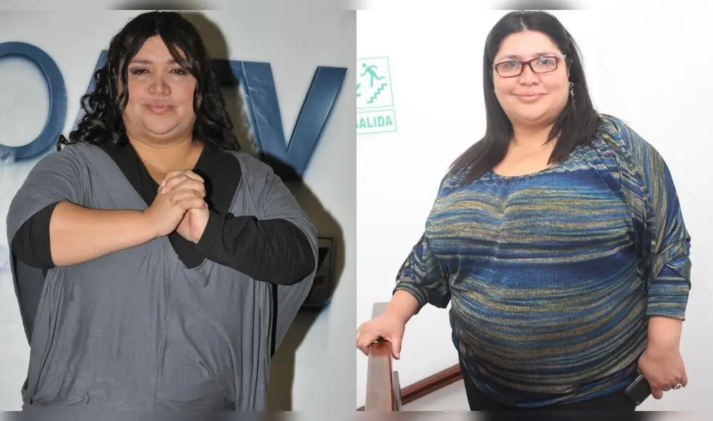 Lucy Cabrera, su antes y después al bajar de peso con banda gástrica