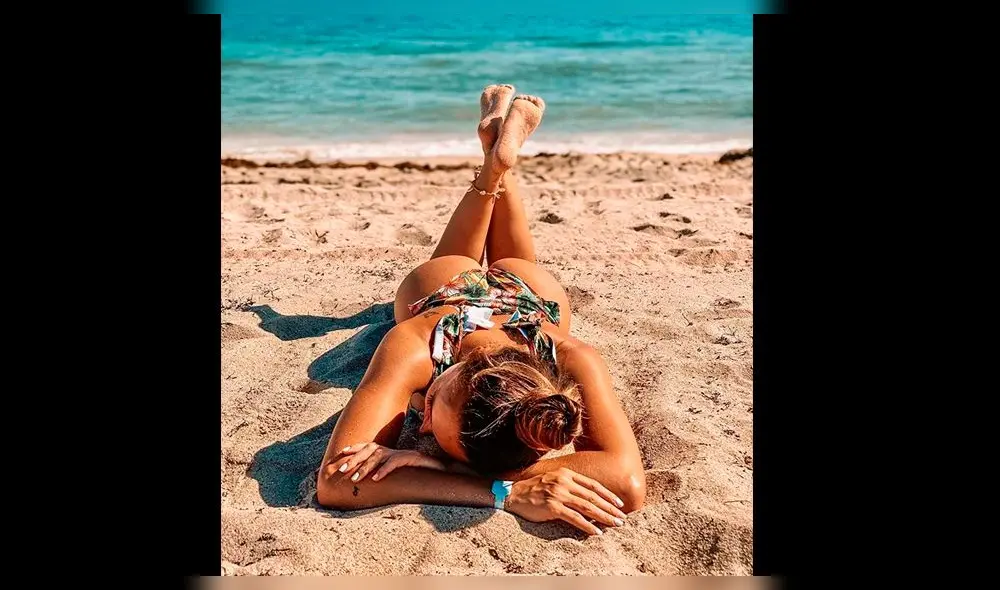 ‘Cachaza’ alerta a fans por aparecer con “moretón” en el ojo [FOTOS]