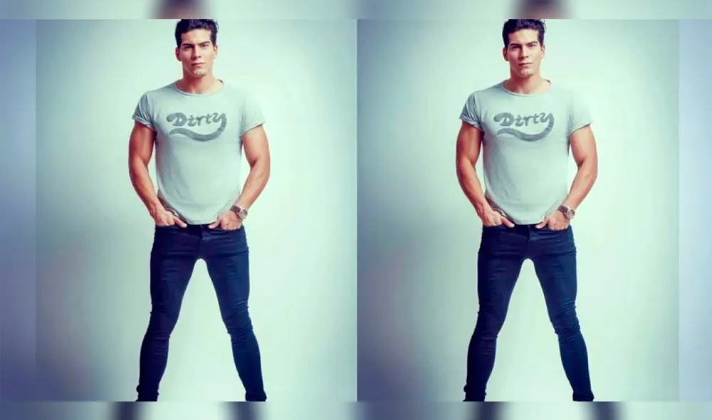 Exchico reality mostró cómo quedó su cuerpo tras sobrevivir al 90% de quemaduras en accidente