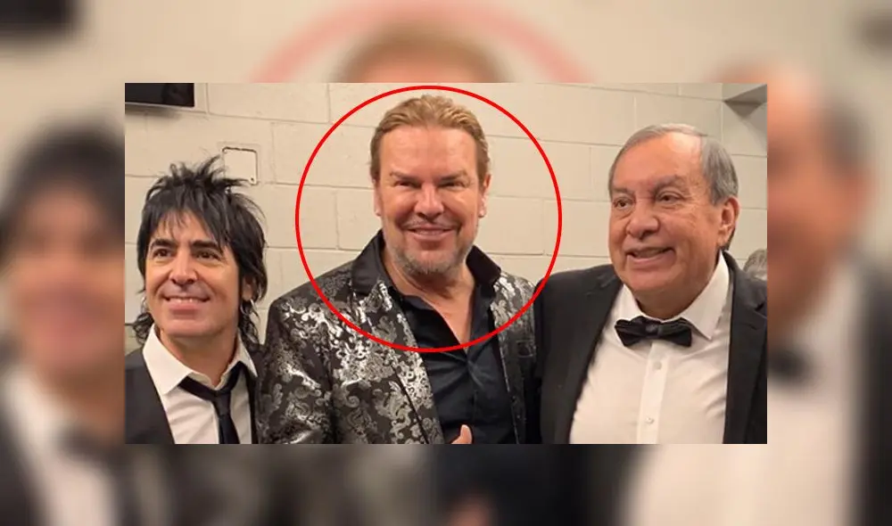 ¿Vocalista de Maná al borde de la muerte por una cirugía estética?