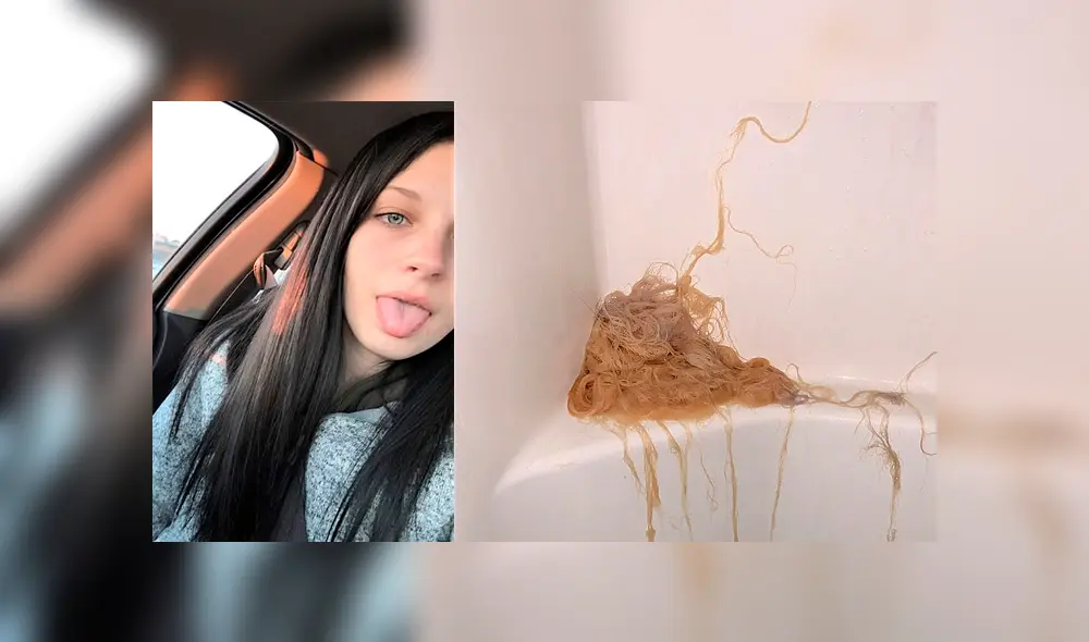 Facebook: Así quedó una joven que intentó decolorarse el cabello con lejía [FOTOS]