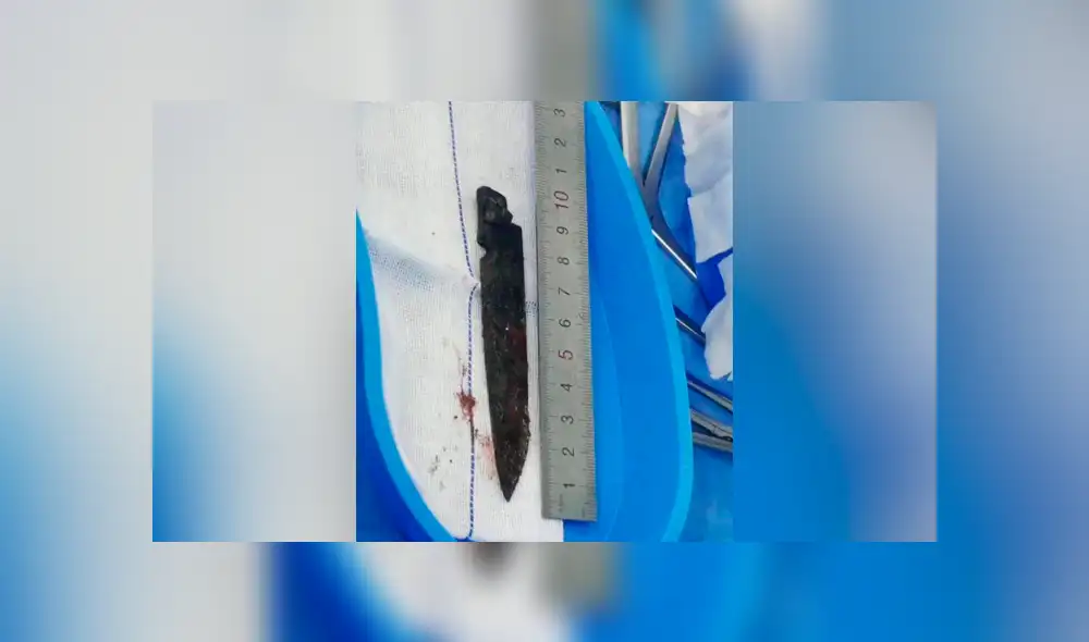 Duorijie sobrevivió al violento asalto, pero acabó con un cuchillo clavado en la cabeza. (Foto: Difusión)