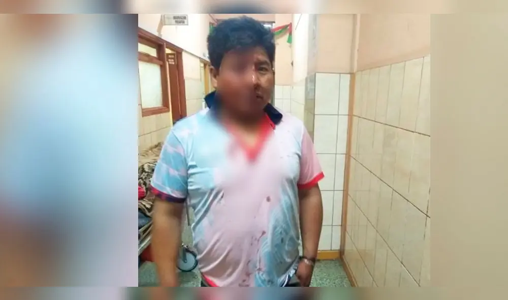 Caso se registró en el distrito de Sachaca.