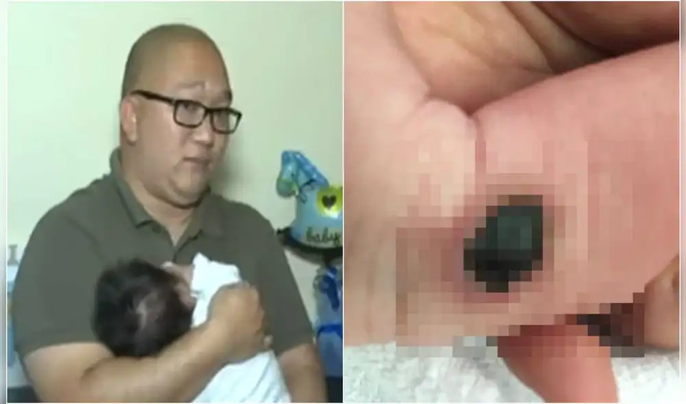 Padre denuncia negligencia en la clínica El Golf por quemadura en la pierna de su hijo [VIDEO]