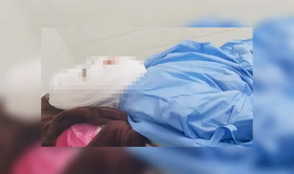 Hombre arroja aceite hirviendo en el rostro de su pareja mientras ella dormía y la deja ciega