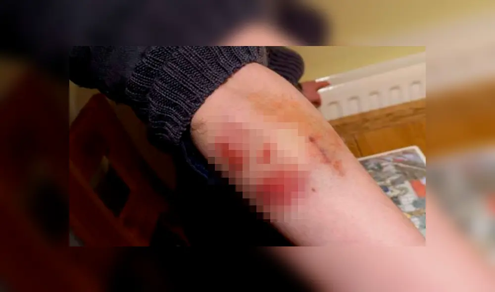 Perro de raza grande ataca a tres mujeres y es condenado a muerte [FOTOS] 