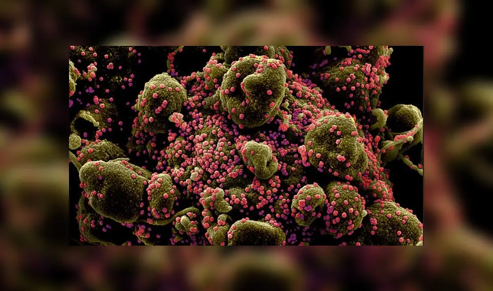 Impactantes imágenes del coronavirus atacando células humanas Impactantes imágenes del coronavirus atacando células humanas