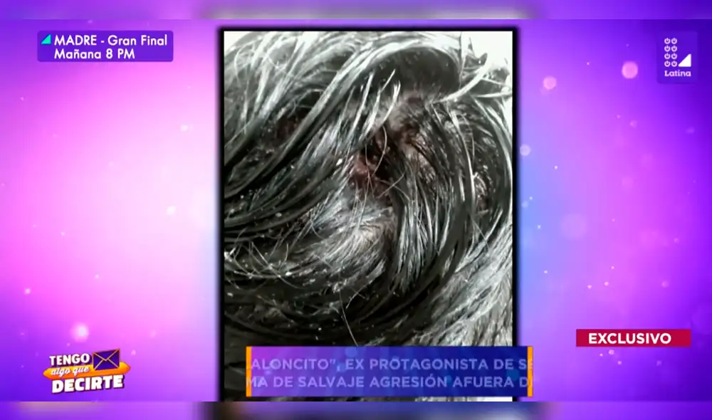 'Chacaloncito' reapareció para denunciar intento de asesinato por ciudadanos extranjeros