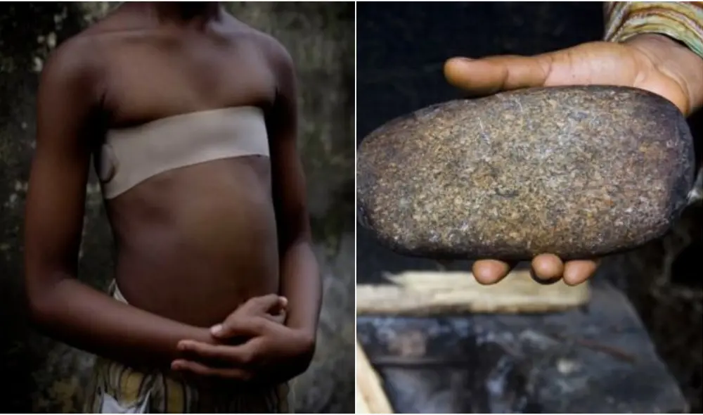 planchado de senos planchado de senos