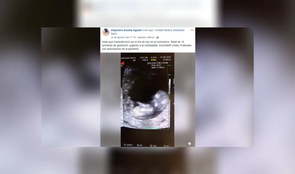 Facebook viral: bebé de 12 semanas juega a la ‘resbaladilla’ en el vientre de su madre y todo queda registrado Facebook viral: bebé de 12 semanas juega a la ‘resbaladilla’ en el vientre de su madre y todo queda registrado