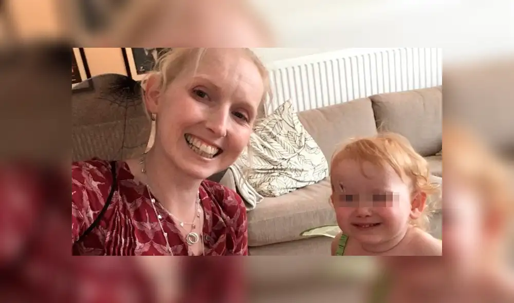 La mujer de 39 años sufre el síndrome de Sjogren. (Foto: NHS) La mujer de 39 años sufre el síndrome de Sjogren. (Foto: NHS)