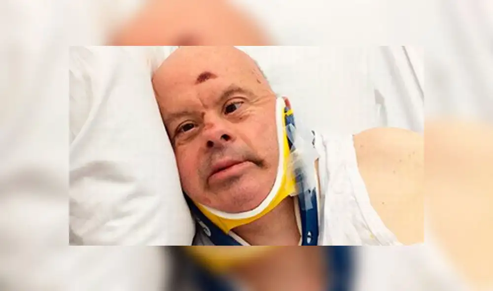 Hospital deja morir de hambre a paciente con síndrome de Down [FOTOS]