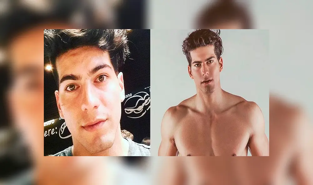 Ignacio Lastra reaparece tras quemarse el 90% del cuerpo: "Esta es mi nueva cara"