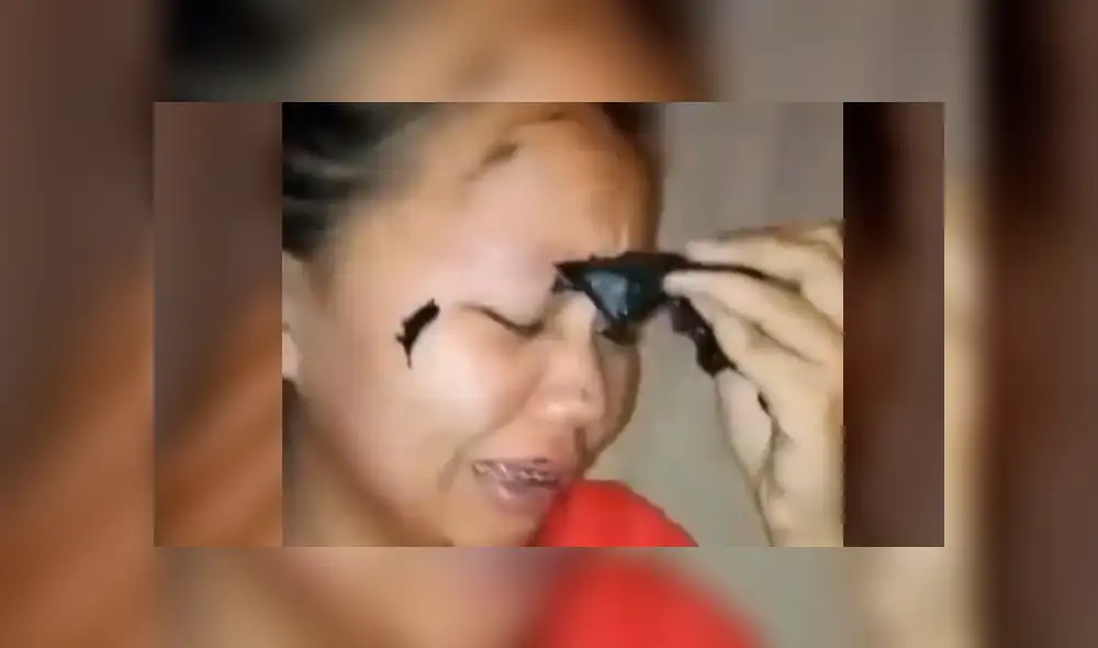 Facebook: muchacha asiática deseaba lucir como estrella K-Pop y se termina 'desfigurando' el rostro