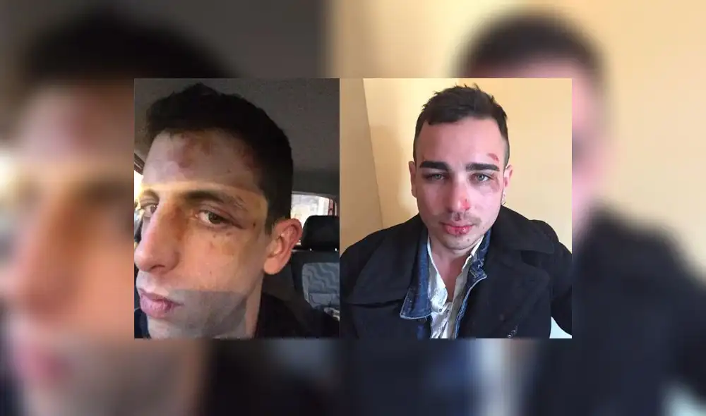 Facebook: golpean a pareja de homosexuales por besarse en frente de todos | VIDEO