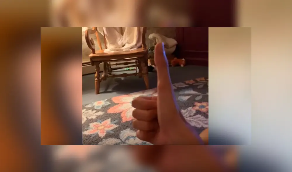 Su extraña condición ha causado sensación en Facebook, luego de difundir su peculiar malformación a través de unos videos