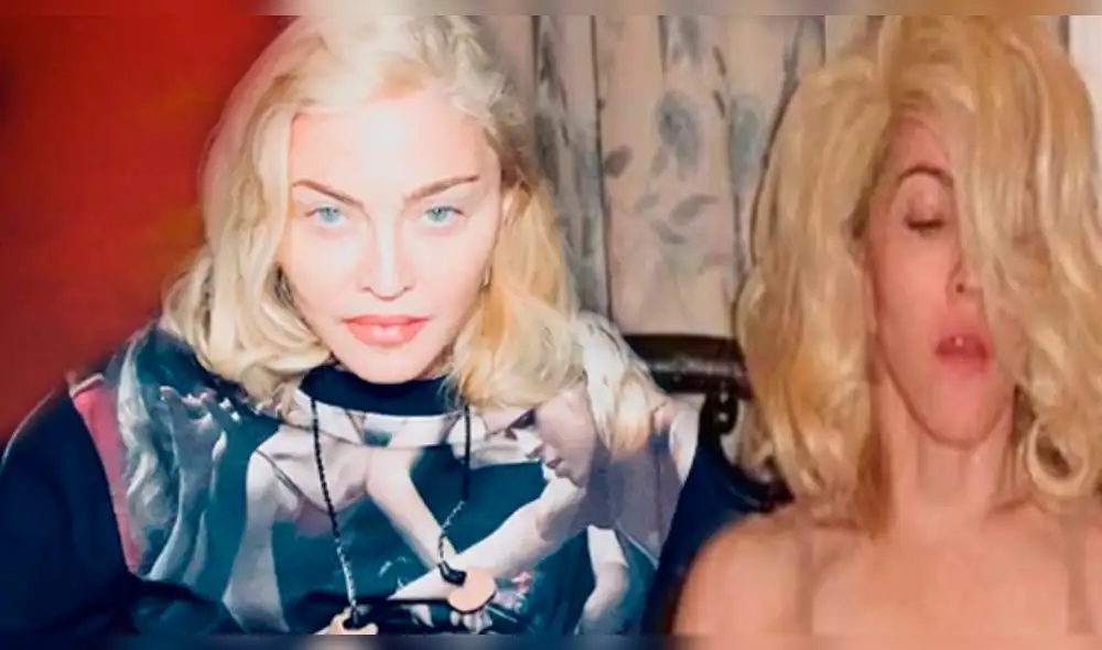 Madonna Instagram cantante enciende las redes al posar en topless para lucir su muleta y reta la censura Madonna Instagram cantante enciende las redes al posar en topless para lucir su muleta y reta la censura