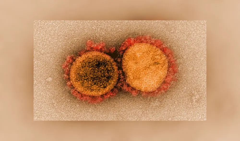 Partículas del coronavirus aisladas de una persona infectada. Imagen: NIH. Partículas del coronavirus aisladas de una persona infectada. Imagen: NIH.