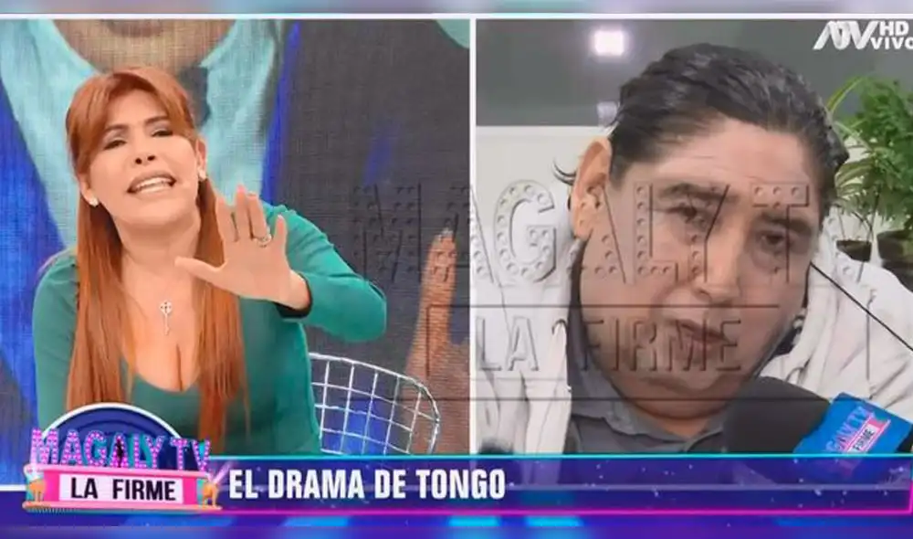 Gerente de seguro afirma que Tongo sí tiene SIS para tratamiento que necesita