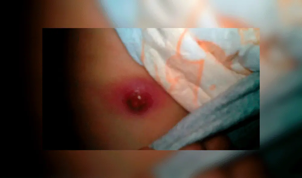 Médicos ignoraron herida por bala de un bebé y solo lo trataron como “mordedura” [FOTOS]