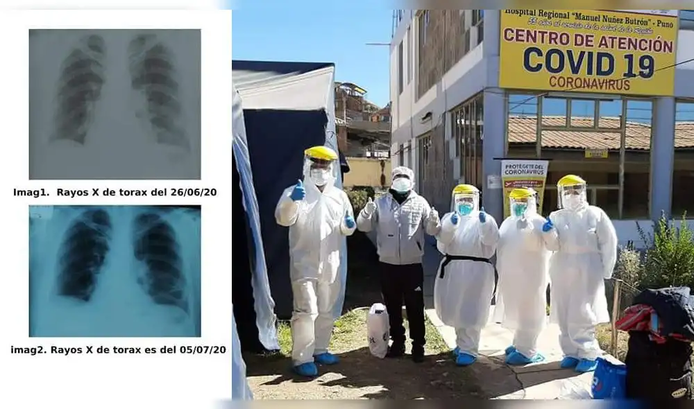 Policía vence a la COVID-19 y es dado de alta de hospital en Puno.