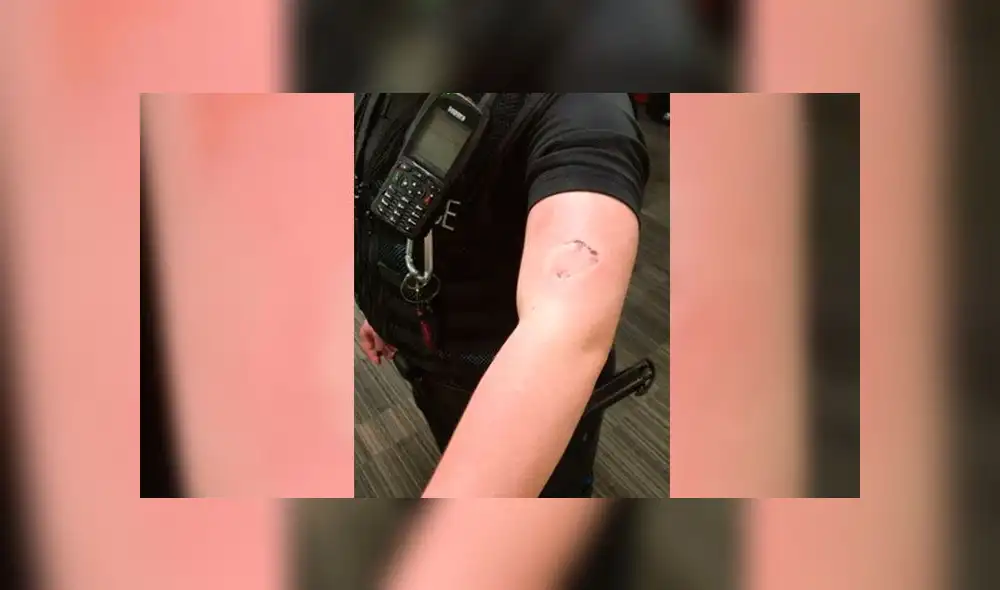 El hombre que la mordió se presentará ante el Tribunal de Magistrados de Manchester. (Fuente: The Sun) El hombre que la mordió se presentará ante el Tribunal de Magistrados de Manchester. (Fuente: The Sun)