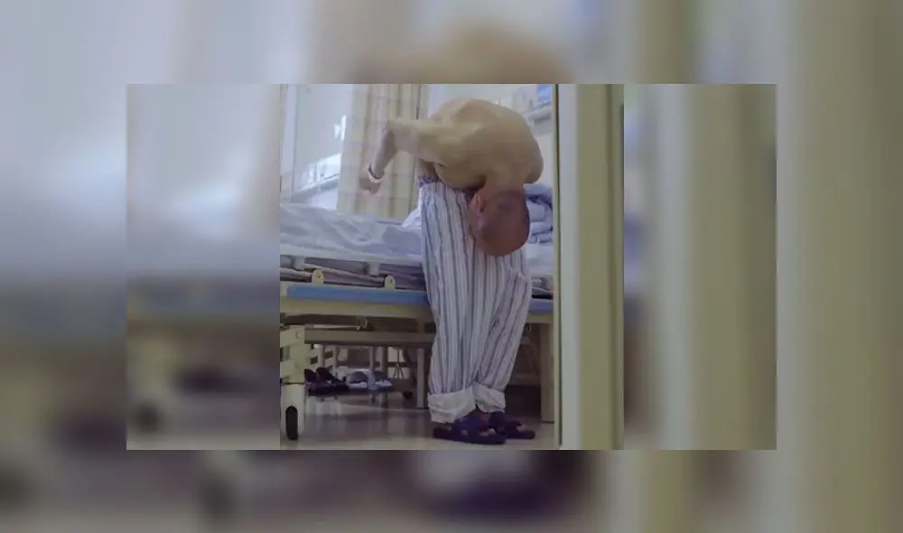 Tuvo el cuerpo doblado por casi tres décadas y volvió a la normalidad gracias a operación [FOTOS]