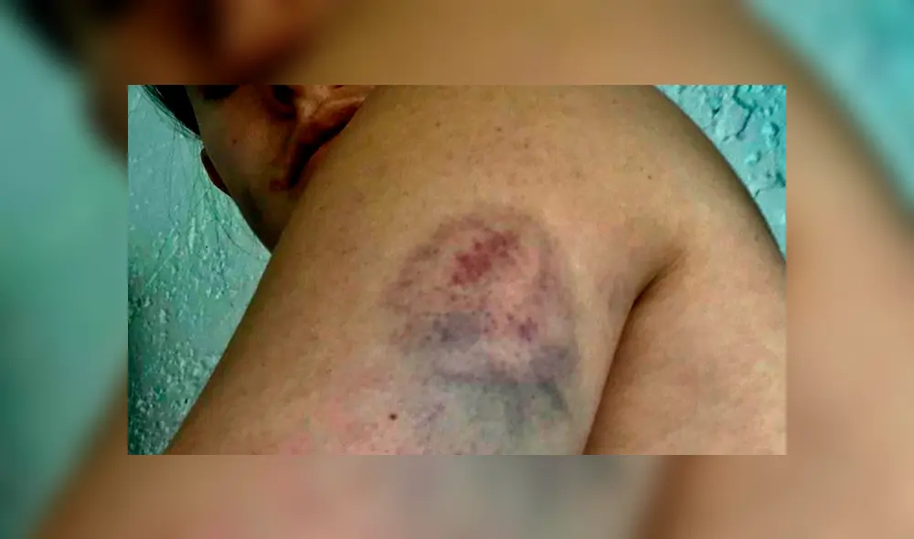 Acusan al nieto de Rogerio Azcárraga de golpear a una mujer [FOTOS]