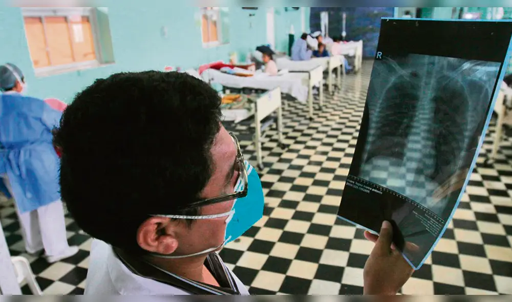 La Libertad: 85 personas fallecieron por TBC el 2018