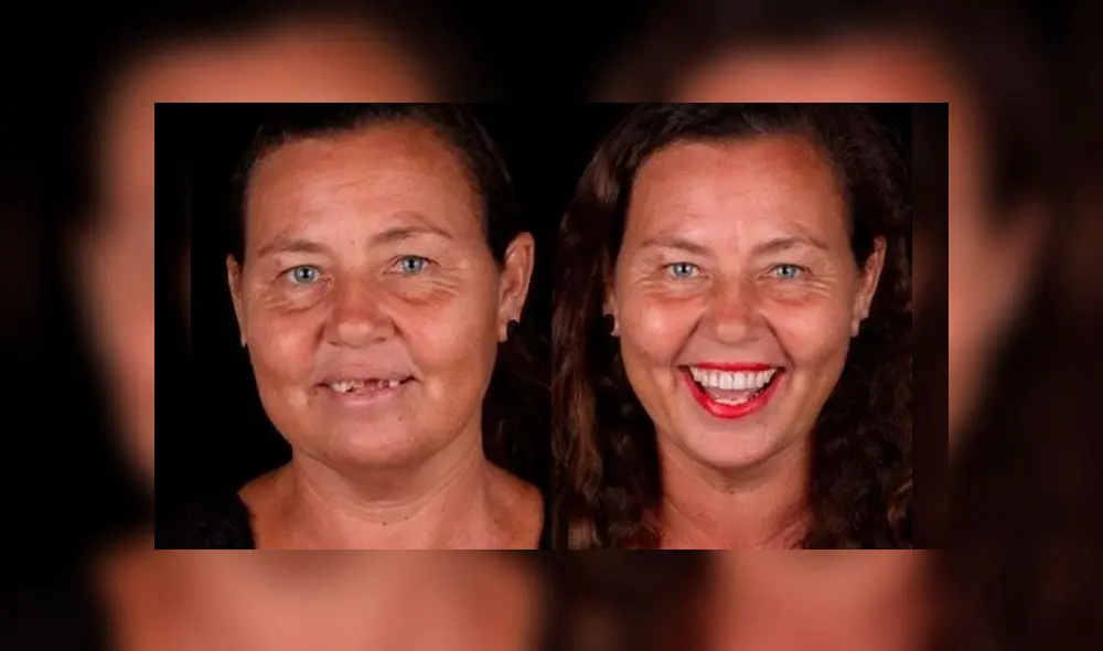 Miles de personas se han beneficiado de las labores de la ONG Por1sorriso. Foto: Instagram Miles de personas se han beneficiado de las labores de la ONG Por1sorriso. Foto: Instagram