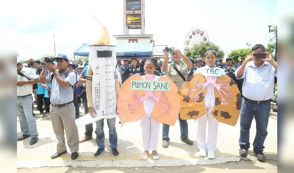 Minsa reporta que 12 regiones tienen calificación de riesgo alto y muy alto para TBC