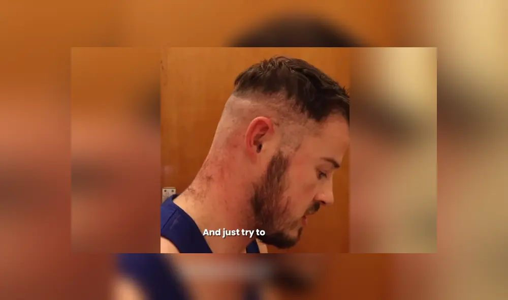 A través de Facebook se hizo viral el terrible resultado de un joven luego de trata de cortarse el cabello por sí mismo.