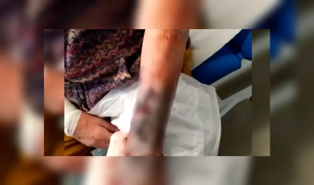 Anciano es agredido brutalmente tras sufrir el robo de su reloj valorizado en 100 000 euros [VIDEO]