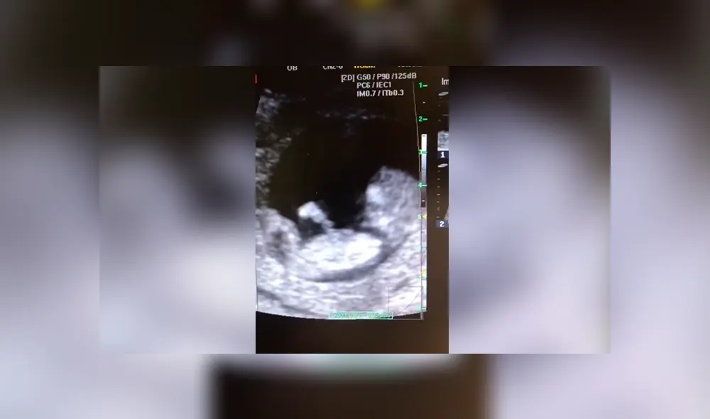 Facebook viral: bebé de 12 semanas juega a la ‘resbaladilla’ en el vientre de su madre y todo queda registrado Facebook viral: bebé de 12 semanas juega a la ‘resbaladilla’ en el vientre de su madre y todo queda registrado