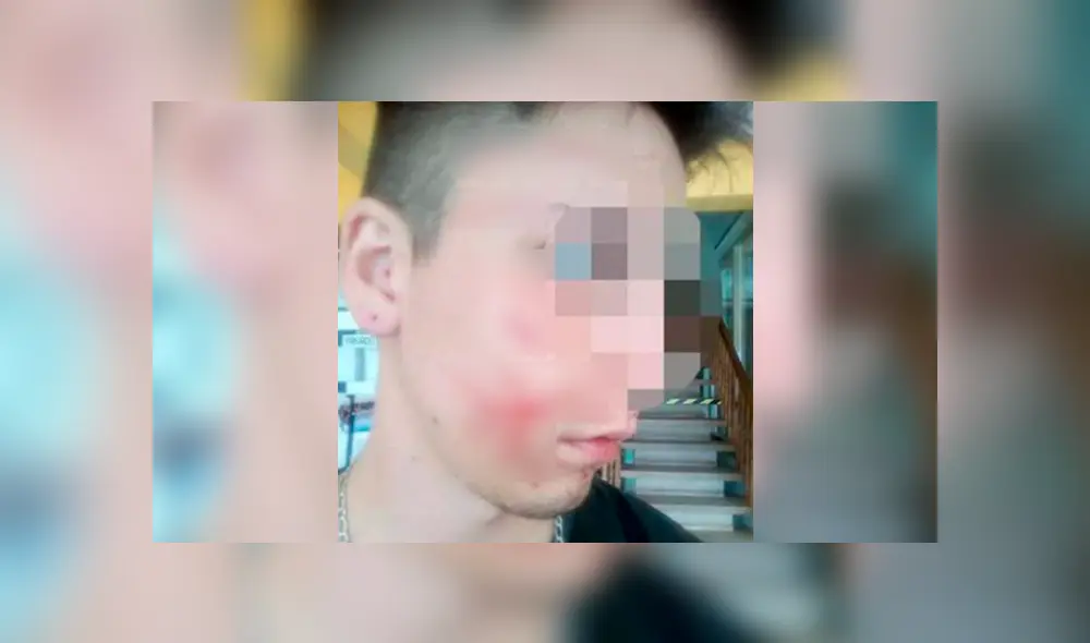 El joven sufrió una fuerte golpiza al defender a su amigo en discoteca. (Foto: El Doce)