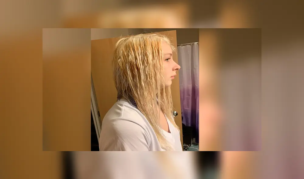 Facebook: Así quedó una joven que intentó decolorarse el cabello con lejía [FOTOS]