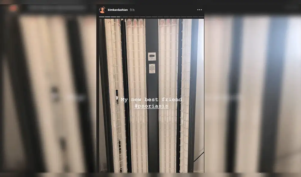 Kim Kardashian muestra impactantes imágenes del efecto de la psoriasis Kim Kardashian muestra impactantes imágenes del efecto de la psoriasis